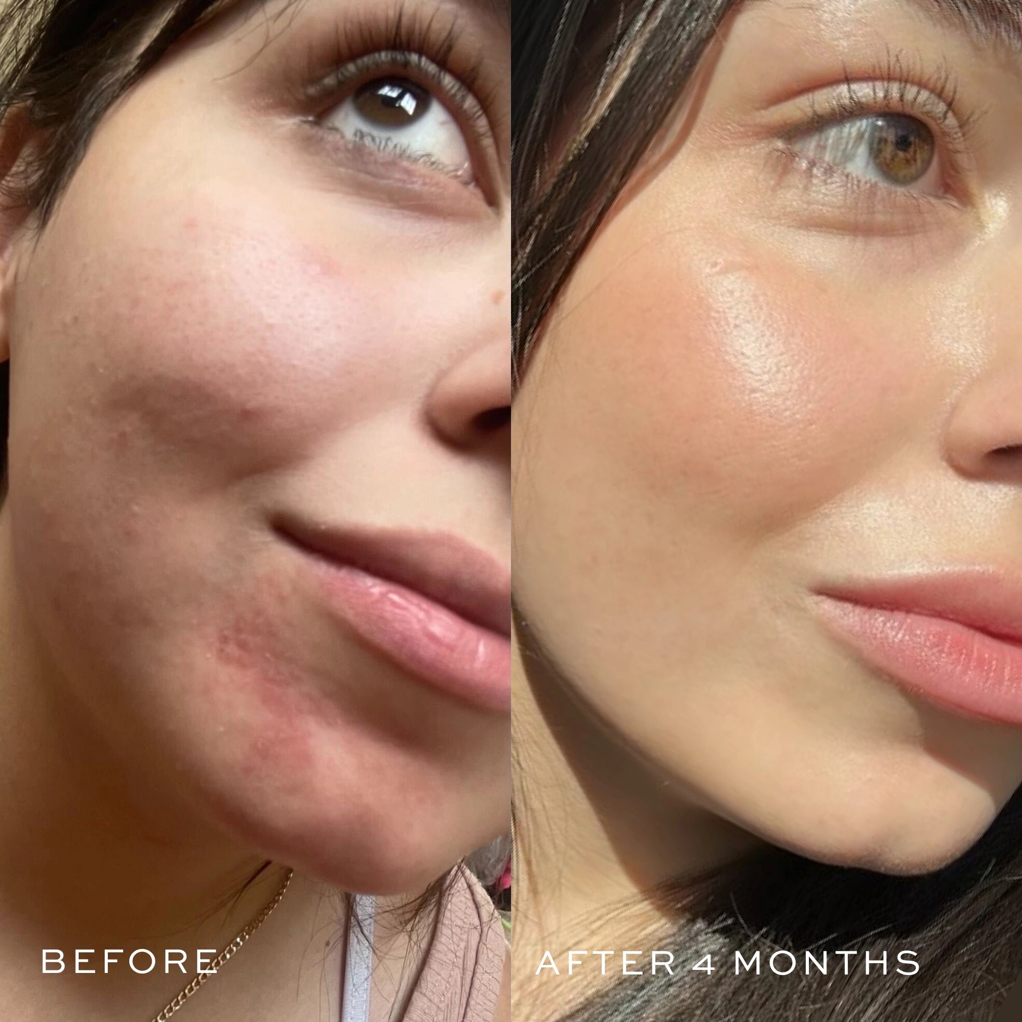 before & after